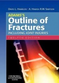 ADAMS'S OUTLINE OF FRACTURES